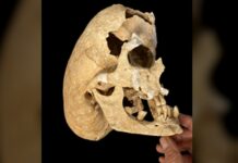 Середньовічний лицар вижив у битві, незважаючи на рідкісне генетичне захворювання