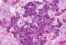 Прорив у лікуванні діабету 1-го типу: Миші Позбавлені Хвороби з Допомога «Гібридної» Імунної Системи