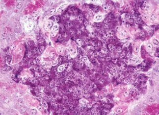 Terobosan Diabetes Tipe 1: Tikus Disembuhkan dengan Sistem Kekebalan ‘Campuran’