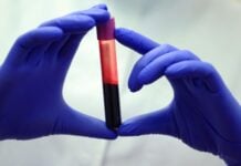 Detekce neviditelného: Nový krevní test založený na strojovém učení odhaluje časné zjizvení jater