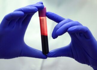 Detectando o invisível: novo exame de sangue com aprendizado de máquina visa cicatrizes precoces no fígado